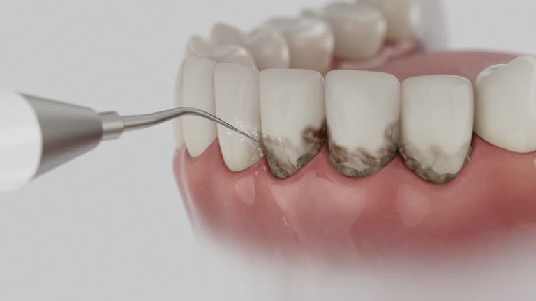 Trusted Root Canal Treatment service in Snyderville, UT - Dentist Open Now